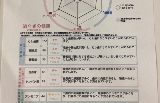 虫歯や歯周病を事前に予防？唾液検査で口の中を知る