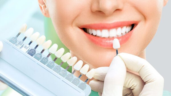 ホワイトニングの施術風景